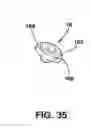 Fig. 27 - Static compression device