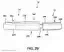 Fig. 31 - Static compression device