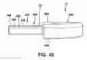 Fig. 35 - Static compression device
