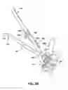 Fig. 49 - Static compression device