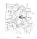 Fig. 09 - Spinal implant system and method