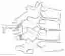 Fig. 01 - Methods and apparatus for coupling a prosthesis to a spinal segment