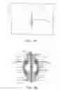 Fig. 06 - Methods and apparatus for coupling a prosthesis to a spinal segment