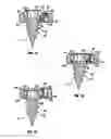 Fig. 02 - Locking confirmation mechanism for a bone screw and plate assembly