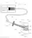 Fig. 01 - Low cost low profile inflatable bone tamp