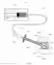 Fig. 07 - Low cost low profile inflatable bone tamp