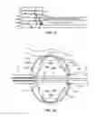Fig. 10 - Post ablation tissue analysis technique