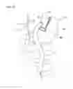 Fig. 16 - Surgical instrument