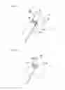 Fig. 28 - Surgical instrument