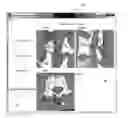 Fig. 01 - Image-based pedicle screw positioning