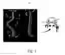 Fig. 02 - Image-based pedicle screw positioning