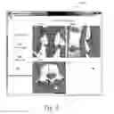 Fig. 06 - Image-based pedicle screw positioning