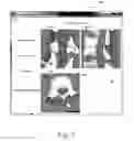 Fig. 07 - Image-based pedicle screw positioning