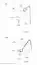 Fig. 16 - Method and devices for hysterectomy