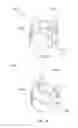 Fig. 29 - Method and devices for hysterectomy
