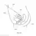 Fig. 59 - Method and devices for hysterectomy