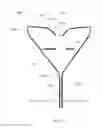 Fig. 64 - Method and devices for hysterectomy