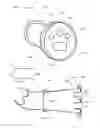 Fig. 78 - Method and devices for hysterectomy