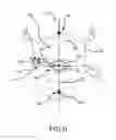 Fig. 07 - Surgical implant alignment device