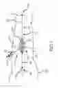 Fig. 08 - Surgical implant alignment device