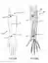 Fig. 10 - Surgical implant alignment device