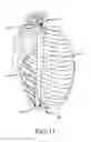Fig. 12 - Surgical implant alignment device