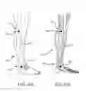 Fig. 16 - Surgical implant alignment device