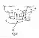 Fig. 09 - Bone foundation guide system and method