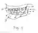Fig. 12 - Bone foundation guide system and method