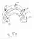 Fig. 17 - Bone foundation guide system and method