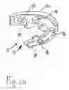 Fig. 22 - Bone foundation guide system and method