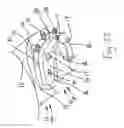 Fig. 24 - Bone foundation guide system and method