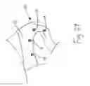 Fig. 26 - Bone foundation guide system and method