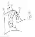 Fig. 28 - Bone foundation guide system and method