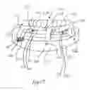 Fig. 31 - Bone foundation guide system and method