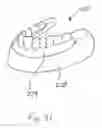 Fig. 33 - Bone foundation guide system and method