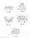 Fig. 03 - Method of using an endentulous surgical guide