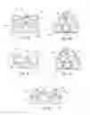 Fig. 04 - Method of using an endentulous surgical guide