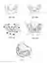 Fig. 06 - Method of using an endentulous surgical guide