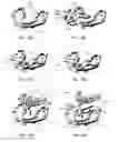 Fig. 19 - Method of using an endentulous surgical guide