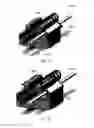 Fig. 12 - Spring based orthodontic device and methods of using thereof