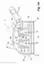 Fig. 02 - Reduced-friction buccal tube and method of use