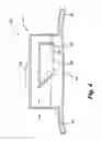 Fig. 06 - Reduced-friction buccal tube and method of use