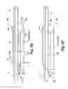 Fig. 08 - Reduced-friction buccal tube and method of use