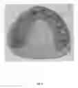 Fig. 04 - DENTAL PROSTHESIS AND METHOD OF ITS PRODUCTION UTILIZING STANDARDIZED FRAMEWORK KEYS AND MATCHING PREMANUFACTURED TEETH