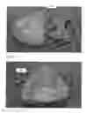Fig. 03 - Modeling and manufacturing of dentures