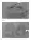 Fig. 04 - Modeling and manufacturing of dentures