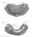 Fig. 07 - Modeling and manufacturing of dentures