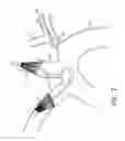 Fig. 12 - Vascular filters, deflectors, and methods