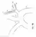 Fig. 15 - Vascular filters, deflectors, and methods